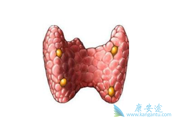 甲状腺腺瘤 甲状腺腺瘤