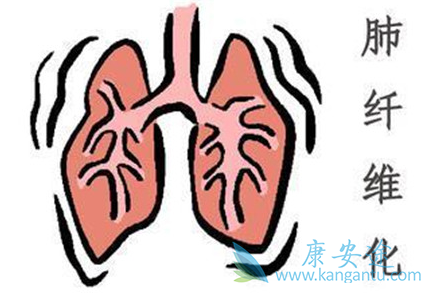 肺纤维化能活多久 肺纤维化能活多久