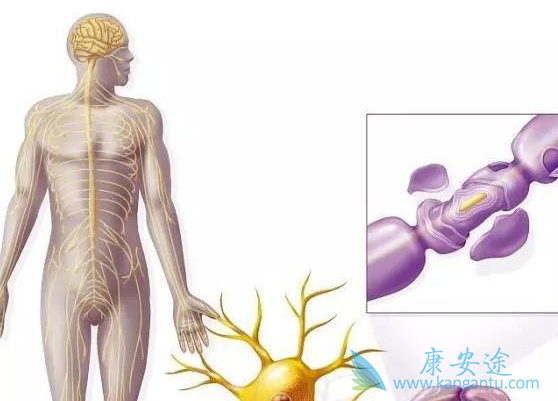 骨髓纤维化 骨髓纤维化