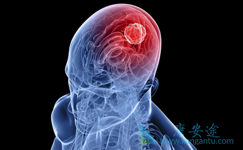脑瘤手术 脑瘤手术
