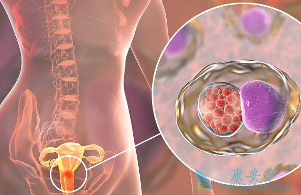 宫颈癌的治疗 宫颈癌的治疗